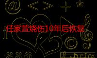 任家萱烧伤10年后恢复营业，今39岁减肥成功“仙女脸”让前夫后悔